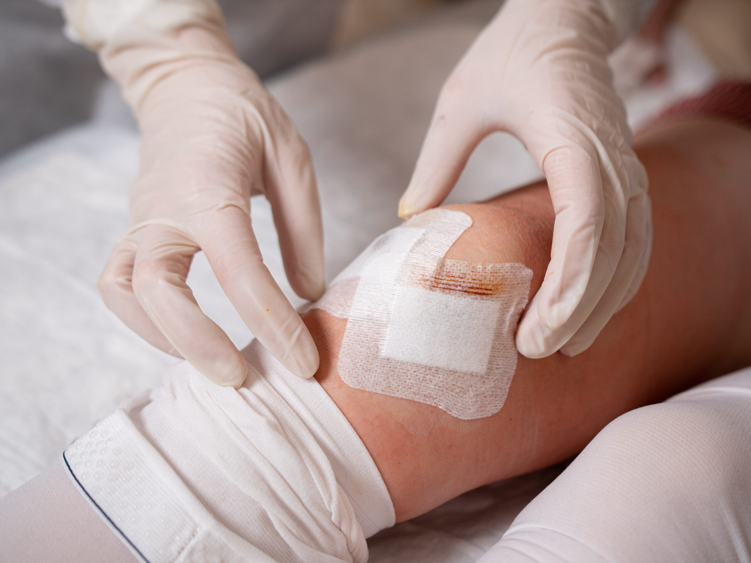 Dr Etienne Maritz Knee Arthroscopy
